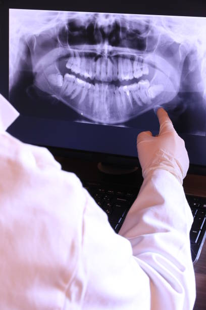 Best Emergency Tooth Extraction in Wellford, SC
